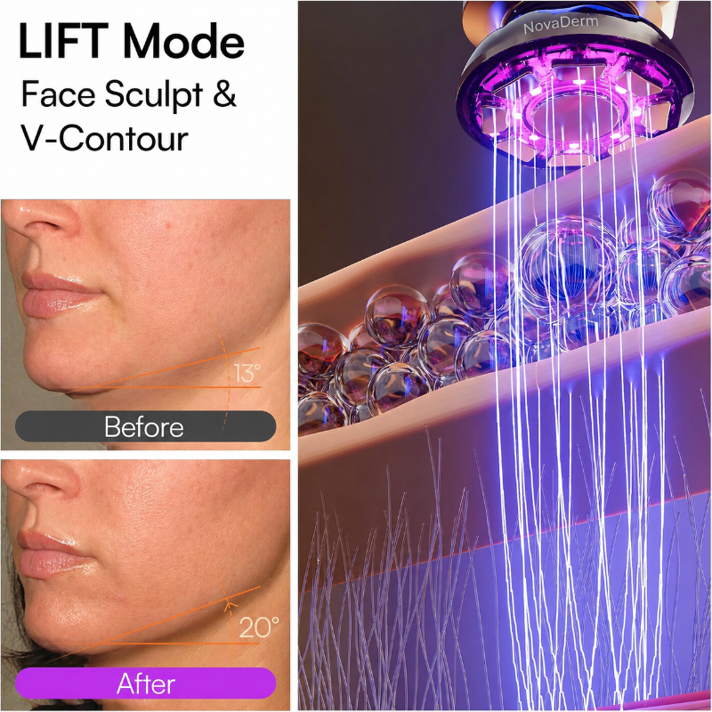 NovaDerm Advanced 3-in-1 Red Light Facial Sculptor